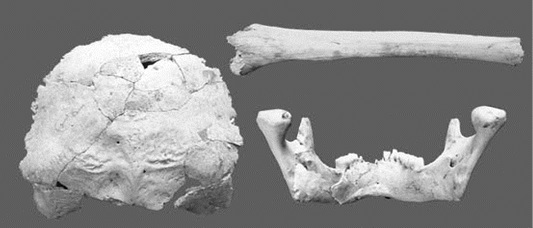 Occipital bone, mandible and radial bone of a Hwangju Man No. 2