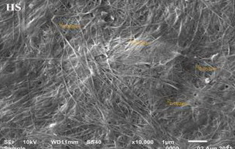 Optimization Of Bacterial Cellulose Production From Alcohol Lees By Intermittent Feeding Strategy